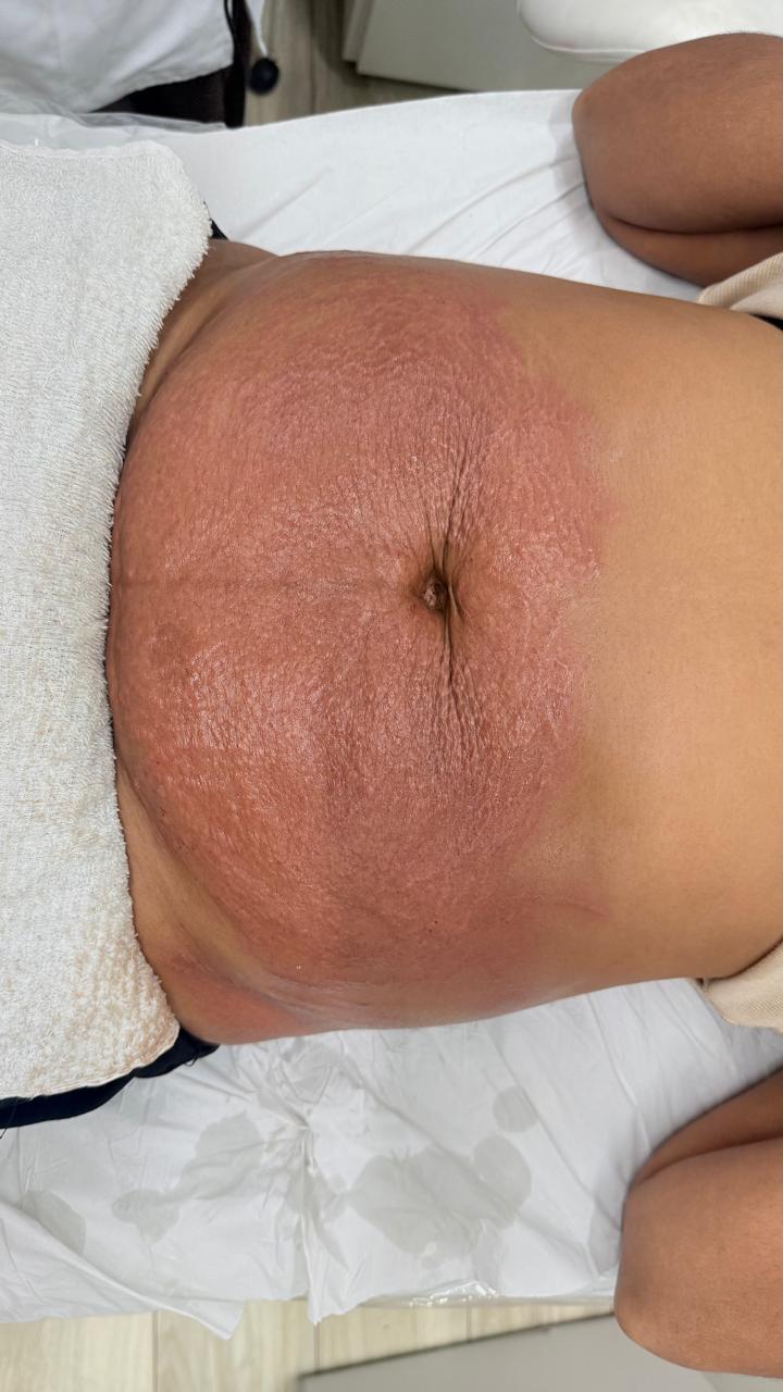 Antes do tratamento 1