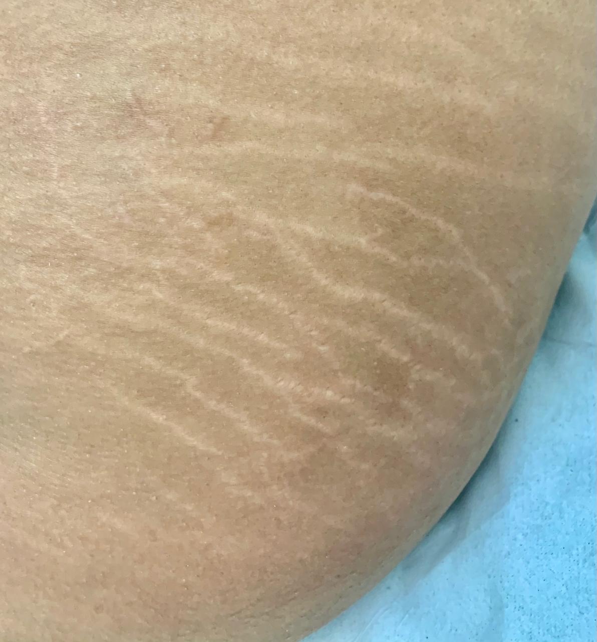 Antes do tratamento 3