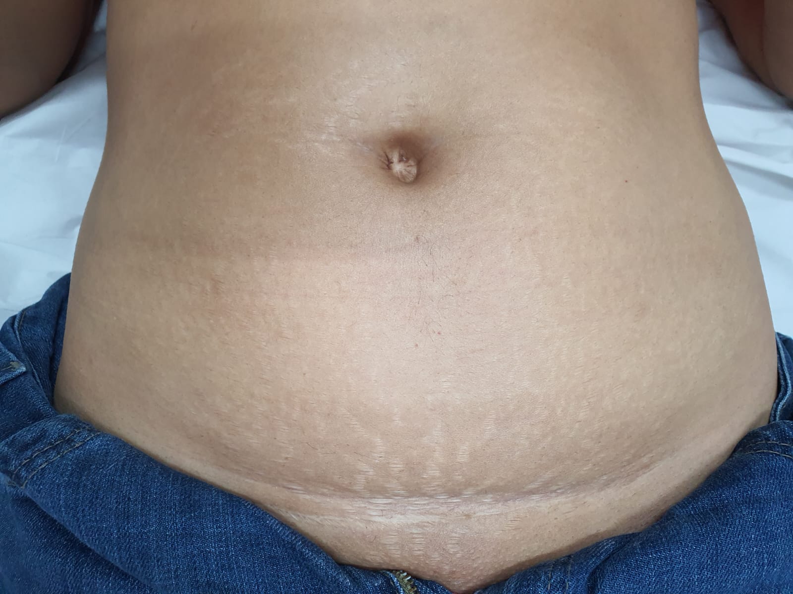 Depois do tratamento 2