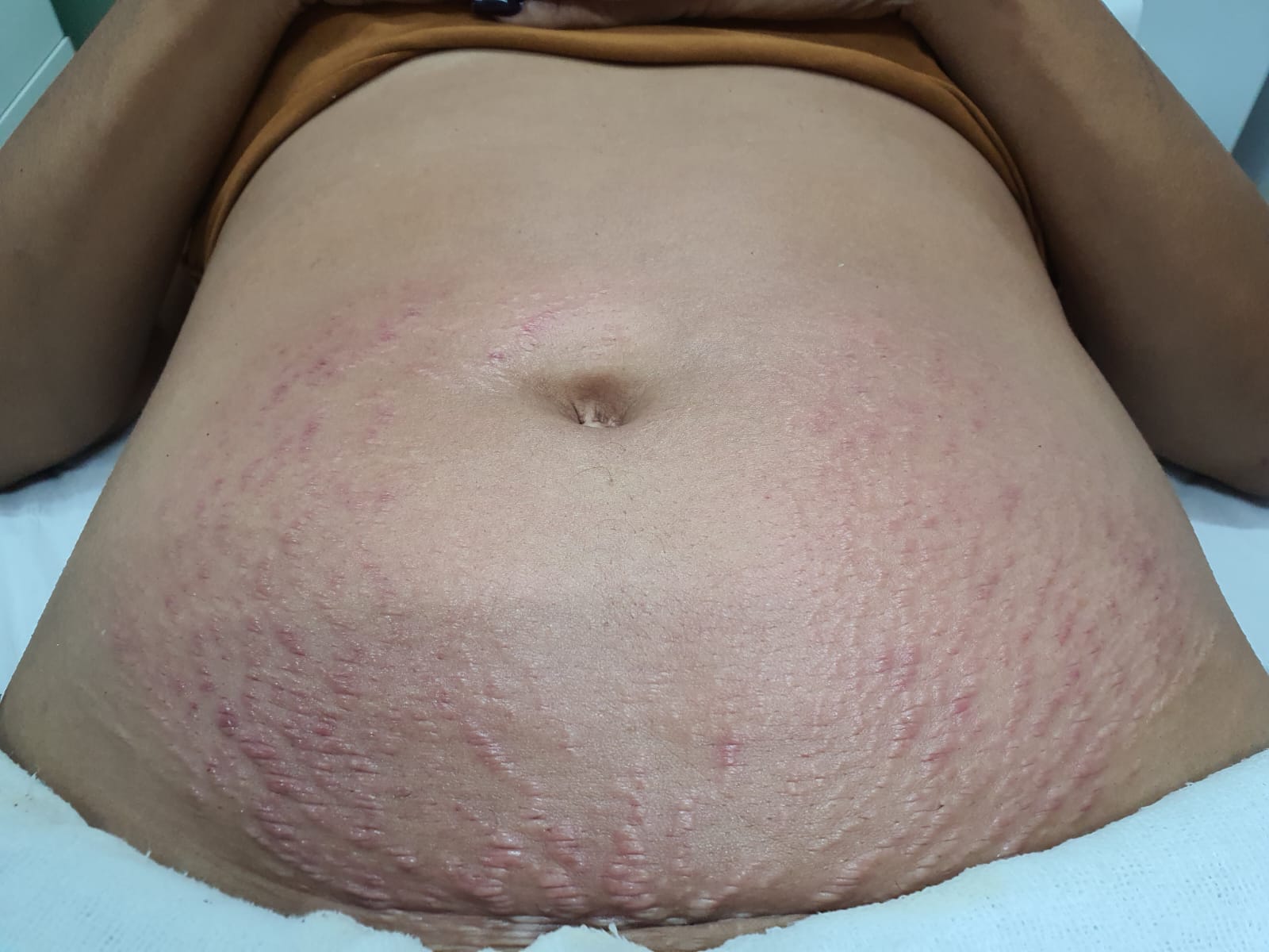 Antes do tratamento 2